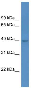 WB Suggested Anti-HPDL Antibody; Titration: 1.0 ug/ml; Positive Control: 293T Whole Cell