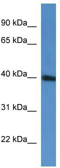 WB Suggested Anti-PRPF38A Antibody Titration: 0.2-1 ug/ml; ELISA Titer: 1:62500; Positive Control: Jurkat cell lysate