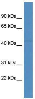 WB Suggested Anti-FBXL20 Antibody; Titration: 1.0 ug/ml; Positive Control: COLO205 Whole Cell