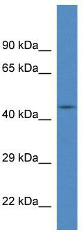 WB Suggested Anti-FBXL20 Antibody; Titration: 1.0 ug/ml; Positive Control: Fetal Brain