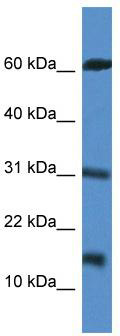 WB Suggested Anti-CARD17 Antibody; Titration: 1.0 ug/ml; Positive Control: Jurkat Whole Cell
