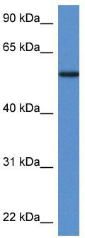 WB Suggested Anti-PGM5 Antibody; Titration: 1.0 ug/ml; Positive Control: Fetal Heart