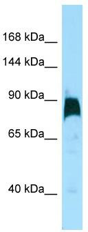 Host: Rabbit; Target Name: KIF7; Sample Tissue: HT1080 Whole cell lysates; Antibody Dilution: 1.0 ug/ml