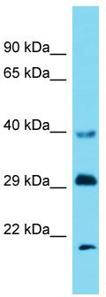 Host: Rabbit; Target Name: Dnalc1; Sample Tissue: Mouse Liver lysates; Antibody Dilution: 1.0 ug/ml