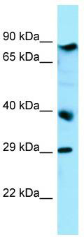 WB Suggested Anti-BRAT1 Antibody; Titration: 1.0 ug/ml; Positive Control: HepG2 Whole Cell