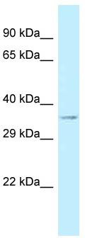 Host: Rabbit; Target Name: CRISPLD1; Sample Tissue: 721_B Whole Cell lysates; Antibody Dilution: 1.0 ug/ml