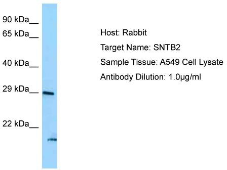 Host: Rabbit; Target Name: SNTB2; Sample Tissue: A549 Whole Cell lysates; Antibody Dilution: 1.0 ug/ml SNTB2 is strongly supported by BioGPS gene expression data to be expressed in Human A549 cells