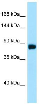 Host: Rabbit; Target Name: C11orf82; Sample Tissue: HepG2 Whole Cell lysates; Antibody Dilution: 1.0 ug/ml