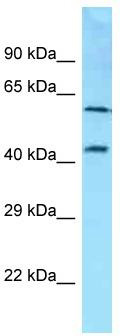 Host: Rabbit; Target Name: SDC3; Sample Tissue: NCI-H226 Whole Cell lysates; Antibody Dilution: 1.0 ug/ml