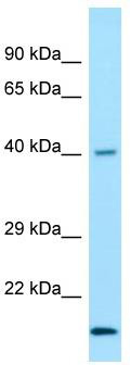 Host: Rabbit; Target Name: NEU3; Sample Tissue: THP-1 Whole Cell lysates; Antibody Dilution: 1.0 ug/ml
