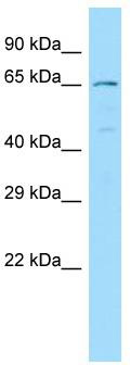 WB Suggested Anti-NCF2 Antibody; Titration: 1.0 ug/ml; Positive Control: MCF7 Whole Cell