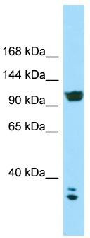 WB Suggested Anti-CACNA2D2 Antibody; Titration: 1.0 ug/ml; Positive Control: HCT15 Whole Cell