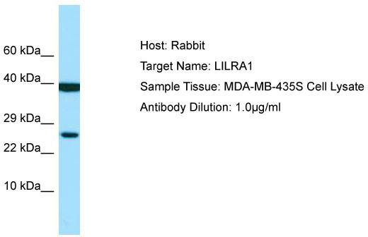 Host: Rabbit; Target Name: LILRA1; Sample Tissue: MDA-MB-435S Whole Cell lysates; Antibody Dilution: 1.0 ug/ml LILRA1 is strongly supported by BioGPS gene expression data to be expressed in Human MDA-MB435 cells