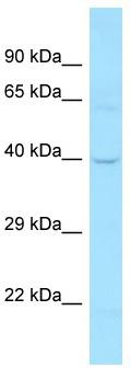 Host: Rabbit; Target Name: DCLK1; Sample Tissue: 721_B Whole Cell lysates; Antibody Dilution: 1.0 ug/ml