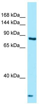 Host: Rabbit; Target Name: THADA; Sample Tissue: MCF7 Whole Cell lysates; Antibody Dilution: 1.0 ug/ml
