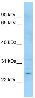 WB Suggested Anti-APOBEC3H Antibody; Titration: 1.0 ug/ml; Positive Control: Jurkat Whole Cell