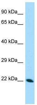 WB Suggested Anti-CDNF Antibody; Titration: 1.0 ug/ml; Positive Control: Hela Whole cell