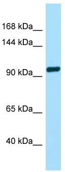 WB Suggested Anti-TAS1R2 Antibody; Titration: 1.0 ug/ml; Positive Control: Fetal Brain