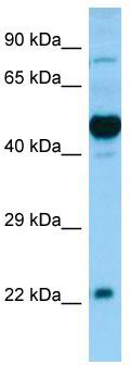 WB Suggested Anti-HCRTR1 Antibody; Titration: 0.25 ug/ml; Positive Control: Fetal Brain