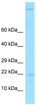 WB Suggested Anti-GKN2 Antibody; Titration: 1.0 ug/ml; Positive Control: Fetal Liver