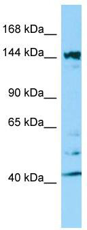 WB Suggested Anti-ITSN2 Antibody; Titration: 1.0 ug/ml; Positive Control: HepG2 Whole Cell