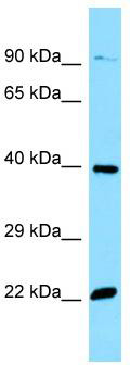 WB Suggested Anti-OR51E2 Antibody; Titration: 1.0 ug/ml; Positive Control: HepG2 Whole Cell