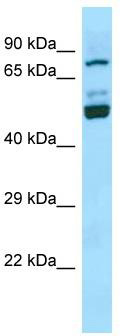 WB Suggested Anti-SEC14L1 Antibody; Titration: 1.0 ug/ml; Positive Control: Jurkat Whole Cell