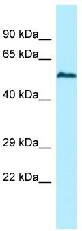 WB Suggested Anti-USP17L5 Antibody; Titration: 1.0 ug/ml; Positive Control: Hela Whole Cell