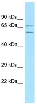 WB Suggested Anti-ECM2 Antibody; Titration: 1.0 ug/ml; Positive Control: 293T Whole Cell