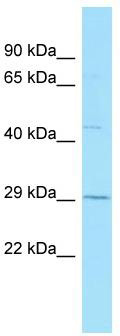 WB Suggested Anti-GPR84 Antibody; Titration: 1.0 ug/ml; Positive Control: Placenta