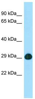 WB Suggested Anti-SLC25A2 Antibody; Titration: 1.0 ug/ml; Positive Control: Fetal Heart