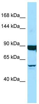 WB Suggested Anti-DNAH9 Antibody; Titration: 1.0 ug/ml; Positive Control: Placenta
