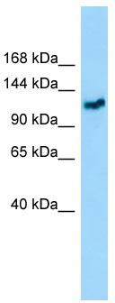 WB Suggested Anti-GMIP Antibody; Titration: 1.0 ug/ml; Positive Control: COLO205 Whole Cell