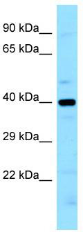 WB Suggested Anti-LIMS2 Antibody; Titration: 1.0 ug/ml; Positive Control: MCF7 Whole Cell