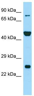 Host: Rabbit; Target Name: PADI6; Sample Tissue: RPMI-8226 Whole Cell lysates; Antibody Dilution: 1.0 ug/ml