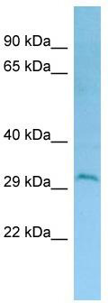 WB Suggested Anti-DERL2 Antibody; Titration: 1.0 ug/ml; Positive Control: HCT15 Whole Cell