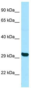 WB Suggested Anti-TBPL2 Antibody; Titration: 1.0 ug/ml; Positive Control: HepG2 Whole Cell