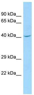 WB Suggested Anti-CDC42EP1 Antibody; Titration: 1.0 ug/ml; Positive Control: THP-1 Whole Cell