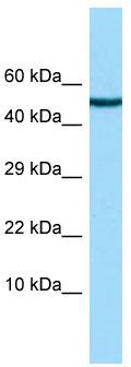 WB Suggested Anti-CHRDL2 Antibody; Titration: 1.0 ug/ml; Positive Control: Hela Whole cell