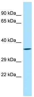 Host: Rabbit; Target Name: SYT8; Sample Tissue: MDA-MB-435S Whole Cell lysates; Antibody Dilution: 1.0 ug/ml