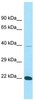 Host: Rabbit; Target Name: FIBP; Sample Tissue: THP-1 Whole Cell lysates; Antibody Dilution: 1.0ug/ml