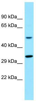 WB Suggested Anti-TAS2R16 Antibody; Titration: 1.0 ug/ml; Positive Control: Placenta