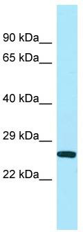 WB Suggested Anti-UQCC Antibody; Titration: 1.0 ug/ml; Positive Control: Placenta
