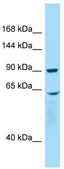 WB Suggested Anti-WHAMM Antibody; Titration: 1.0 ug/ml; Positive Control: Placenta