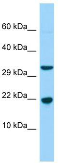 WB Suggested Anti-CABP5 Antibody; Titration: 1.0 ug/ml; Positive Control: Fetal Liver