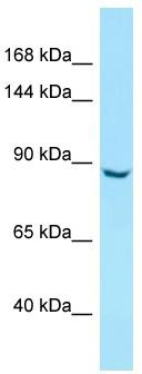 WB Suggested Anti-ITIH5 Antibody; Titration: 1.0 ug/ml; Positive Control: HepG2 Whole Cell