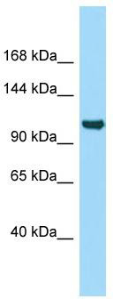 WB Suggested Anti-ITIH5 Antibody; Titration: 1.0 ug/ml; Positive Control: PANC1 Whole Cell