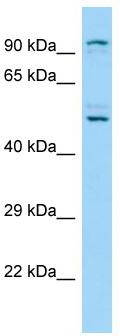Host: Rabbit; Target Name: KDM1B; Sample Tissue: A549 Whole Cell lysates; Antibody Dilution: 1.0ug/ml
