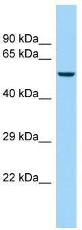 WB Suggested Anti-KRT85 Antibody; Titration: 1.0 ug/ml; Positive Control: OVCAR-3 Whole CellKRT85 is supported by BioGPS gene expression data to be expressed in OVCAR3