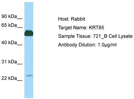 Host: Rabbit; Target Name: KRT85; Sample Tissue: 721_B Whole Cell lysates; Antibody Dilution: 1.0ug/ml